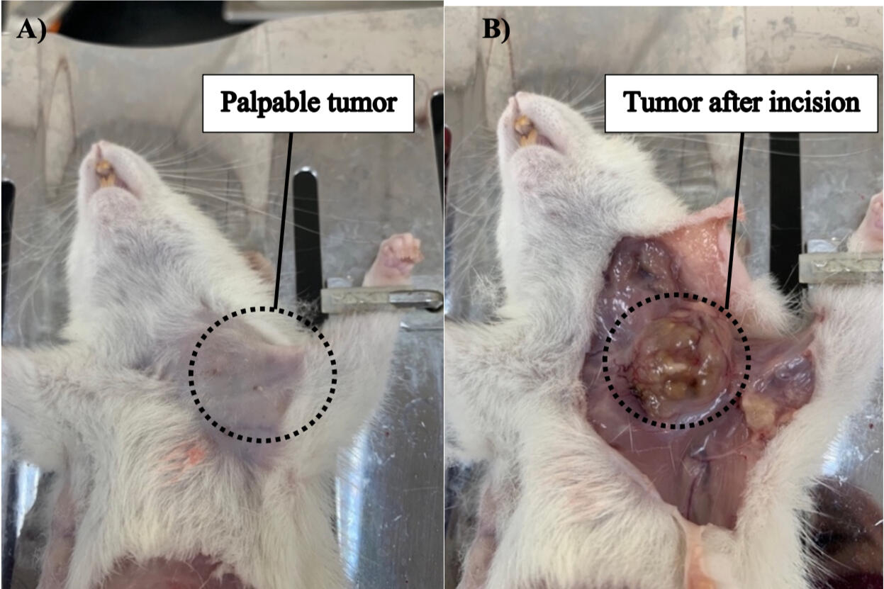 Removing breast tumor. (A) Palpable tumor before surgery. (B) Revealing tumor after incision on the breast skin. (MSc thesis, Ro