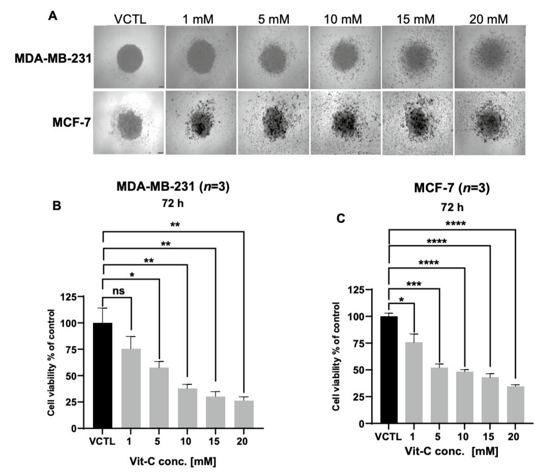 Removing breast tumor. (A) Palpable tumor before surgery. (B) Revealing tumor after incision on the breast skin. (MSc thesis, Ro