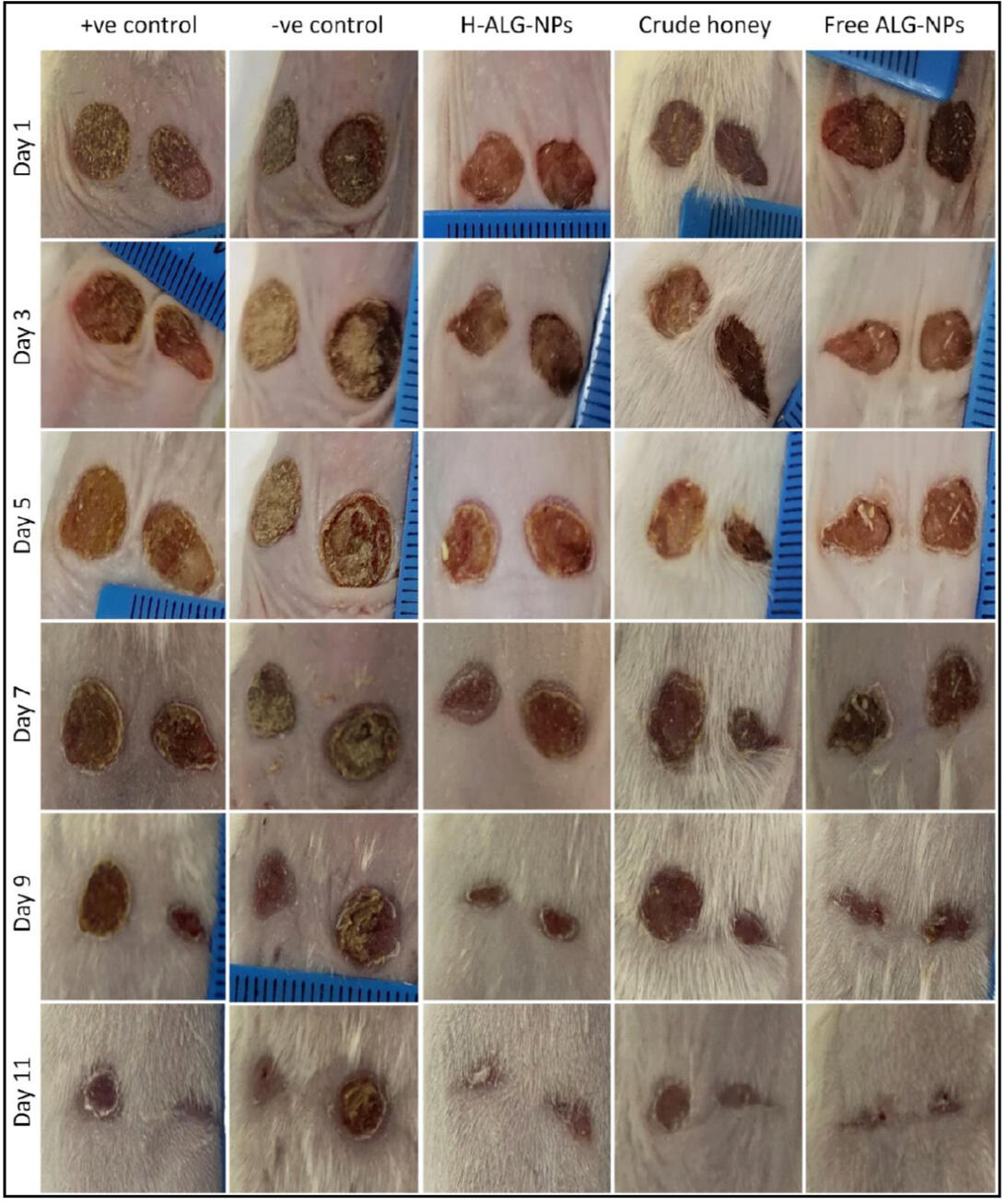 Removing breast tumor. (A) Palpable tumor before surgery. (B) Revealing tumor after incision on the breast skin. (MSc thesis, Ro